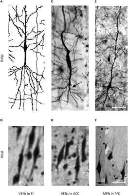 Von Economo neurons as a specialized neuron class of the human cerebral cortex